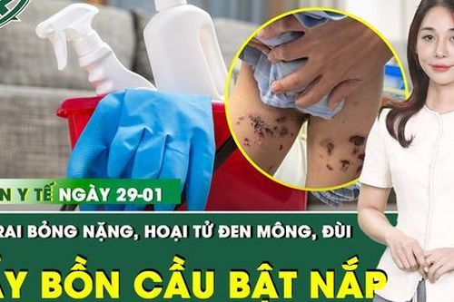 Bản tin Y tế 29/1: Bé trai bỏng mông, đùi do nước tẩy bồn cầu