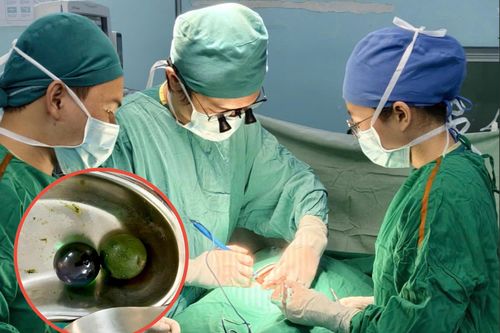Bé gái 18 tháng tuổi nguy kịch, ruột tắc nghẽn vì nuốt hạt nở đồ chơi