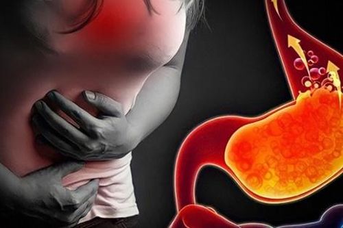 Biến chứng nguy hiểm của bệnh trào ngược dạ dày thực quản