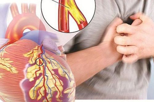 Xét nghiệm máu giúp dự đoán sớm bệnh cơ tim phì đại