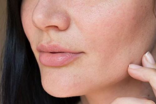 Ngứa ngáy da mặt, khó chịu, cảnh giác với nhiễm nấm