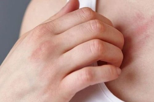 6 dấu hiệu 'không đau' của ung thư giai đoạn đầu, nhiều người đang bỏ qua