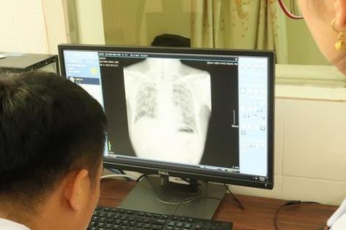 Bộ Y tế nói gì về phản ánh liên quan đến vướng mắc thanh toán BHYT chụp X-quang?