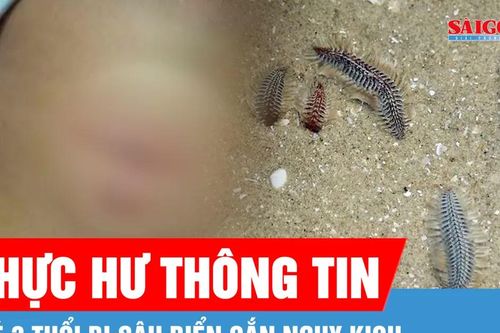 Thực hư thông tin bé 3 tuổi bị sâu biển cắn nguy kịch