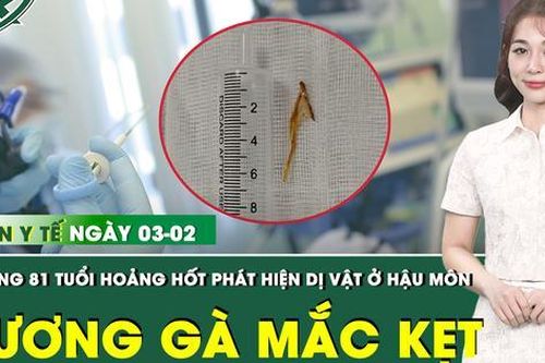 Bản tin Y tế 3/2: Phát hiện dị vật là mảnh xương gà hơn 3cm mắc kẹt ở hậu môn cụ ông