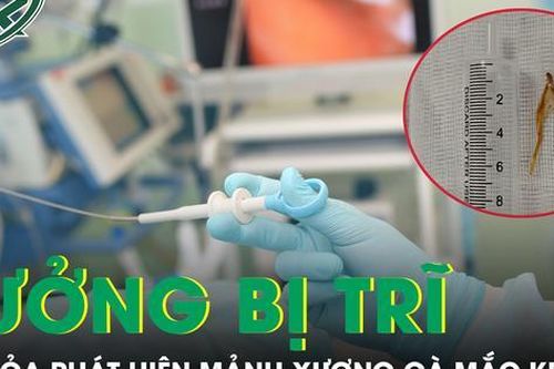 Tưởng bệnh trĩ tái phát, người đàn ông tá hỏa phát hiện mảnh xương gà mắc kẹt