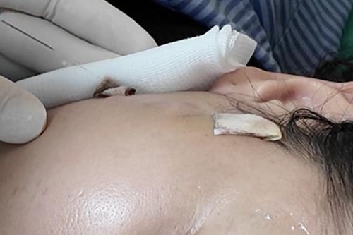 Đón Tết chưa kịp đẹp, người phụ nữ 40 tuổi 'vỡ mộng' vì sự cố bất ngờ
