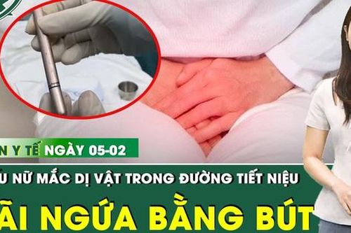Bản Tin Y Tế 5/1: Chiếc bút mắc kẹt trong đường tiết niệu thiếu nữ 16 tuổi