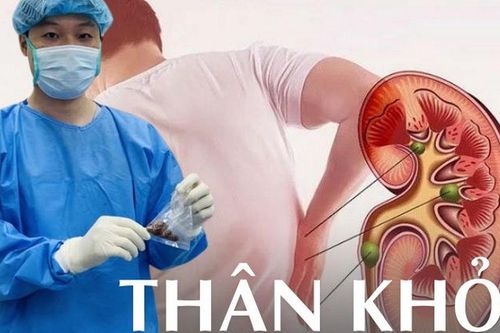 'Cầm dao mổ rồi mới thấy, nhiều quả thận ra đi mãi oan uổng chỉ vì thiếu hiểu biết': 30 cảnh báo từ BS phòng mổ, ai cũng phải đọc