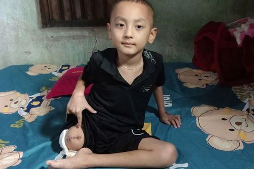 Ung thư cướp mất chân của cậu bé 6 tuổi, gia đình kiệt quệ cầu mong phép màu