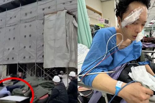 Tai nạn bất ngờ khiến diễn viên Tô Đức Dương gãy xương mặt, hôn mê