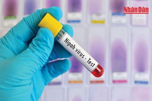 Châu Á quyết liệt phòng, chống virus Nipah