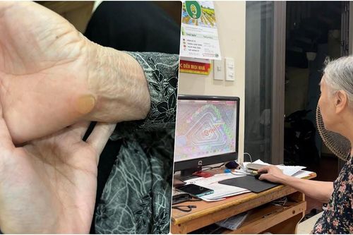 Cụ bà U90 chai tay vì nghiện Zuma, 9x đọc là thấy tuổi thơ