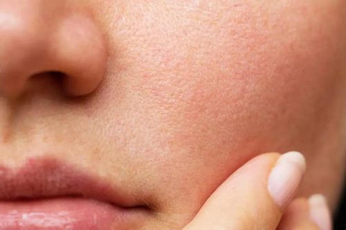 Những dấu hiệu trên da cho thấy cơ thể đang căng thẳng