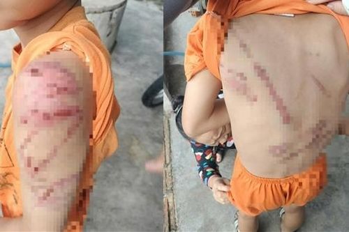 Điều tra vụ bé trai 10 tuổi bị bố bạo hành