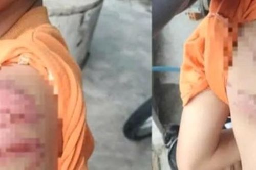 Công an điều tra vụ bé trai nghi bị cha ruột đánh