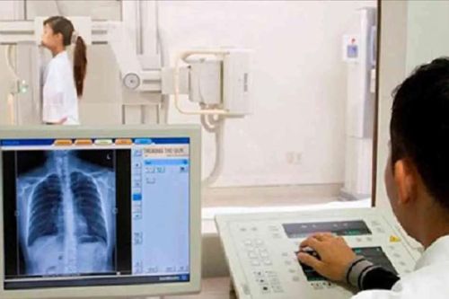 Đề nghị không áp dụng thông số thời gian chụp X-quang để thanh toán BHYT