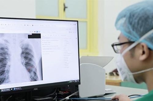 Không lấy thời gian chụp X-quang 6 phút làm căn cứ từ chối thanh toán BHYT