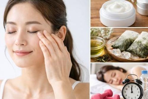Vì sao người trẻ cũng bị bọng mắt, cải thiện thế nào?