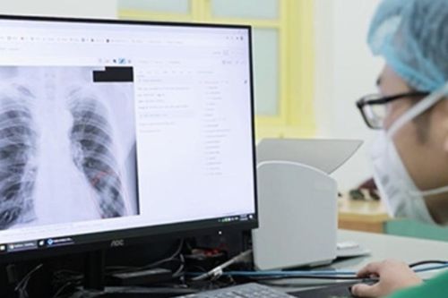 Bộ Y tế phản hồi việc từ chối thanh toán bảo hiểm y tế khi chụp X-quang dưới 6 phút
