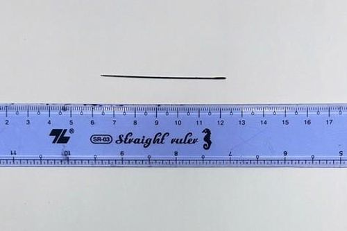 Lấy thành công kim khâu dài 6 cm nằm trong gan người đàn ông