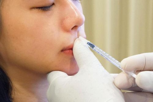 Tăng số ca nhập viện vì 'làm đẹp đón Tết'