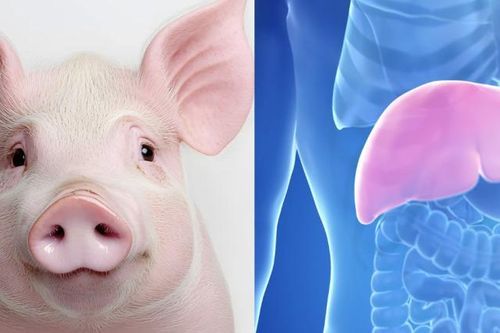 Gan lợn biến đổi gene mở ra hướng đi mới trong điều trị suy gan cấp