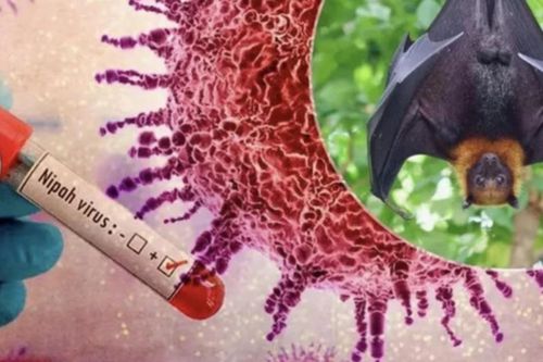 Bộ Y tế hướng dẫn chẩn đoán và điều trị bệnh do virus Nipah