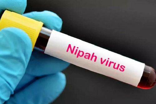 Bộ Y tế ban hành hướng dẫn phòng, chống virus Nipah