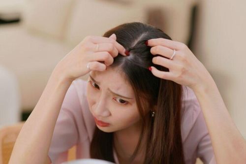 Tóc rụng liên tục, ngày càng mỏng, chuyên gia bật mí 10 thói quen 'cứu nguy' giúp tóc con mọc lên tua tủa
