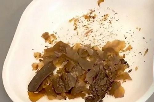 Khám phá mới về cách người La Mã cổ đại điều trị y học