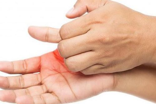 Tay lạnh trong mùa lạnh là bệnh gì, nguy hiểm không?