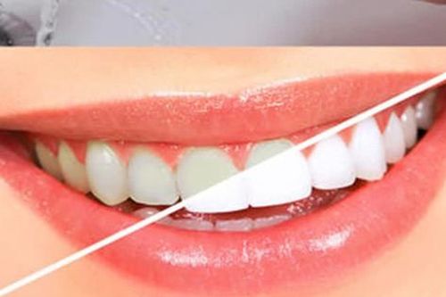 5 cách giúp trắng răng, giữ hơi thở thơm tho - bạn đã biết chưa?