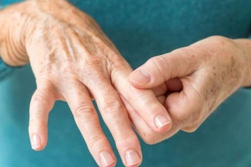 Thường xuyên tê tay vào ban đêm, coi chừng hội chứng ống cổ tay