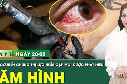 Bản tin Y tế 20/2: Hàng chục người mắc biến chứng thị lực hiếm gặp sau xăm hình