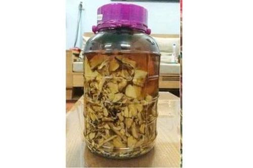 Đừng để rượu là sát thủ thầm lặng