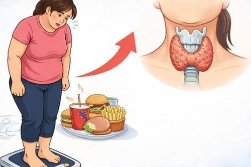 Vì sao ăn ít vẫn tăng cân? Những nguyên nhân nhiều người bỏ qua