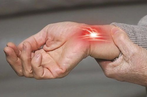 Phát hiện sớm hội chứng ống cổ tay, tránh tổn thương lâu dài