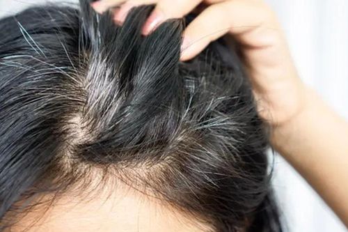 Liệu người tóc bạc ít khả năng mắc ung thư hơn? Có bằng chứng khoa học nào không? Câu trả lời đã có ở đây