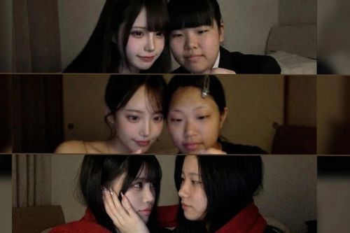 Trào lưu cực 'hot' ghép ảnh trước - sau thẩm mỹ bằng AI gây lo ngại