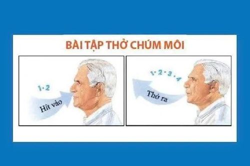Kỹ thuật thở đơn giảng giúp người bệnh phổi cải thiện chức năng hô hấp