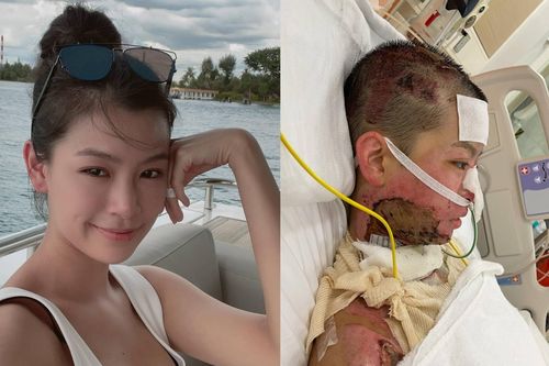 Tiếp viên hàng không từng bỏng 80% cơ thể vì cứu hôn phu giờ ra sao?
