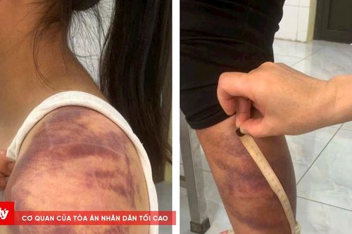 Chồng đánh đập, bạo hành vợ đang mang thai và con nhỏ