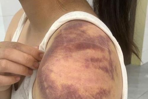 Bắt đối tượng ngược đãi, hành hạ vợ và con gái