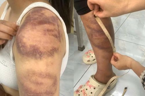 Tạm giữ gã chồng 4 lần đánh đập vợ bầu và con gái 13 tuổi