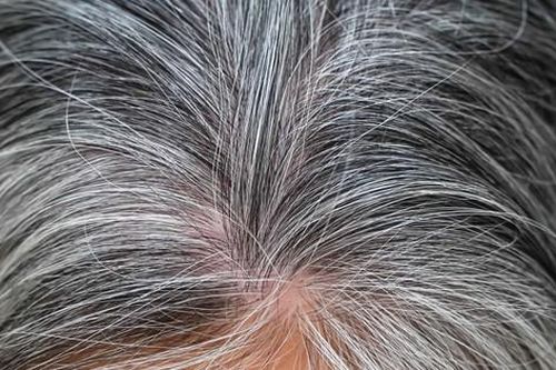 Các giải pháp làm chậm và hỗ trợ phục hồi tóc bạc sớm