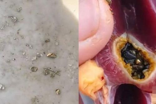 Mổ vịt ăn Tết, người đàn ông sốc nặng khi thấy vàng bên trong