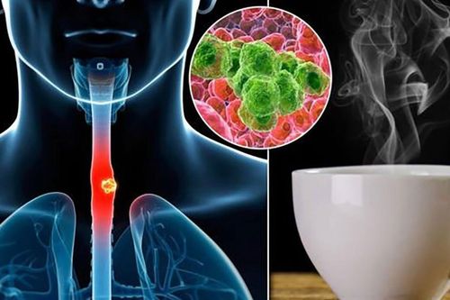 Loại nước uống theo cách 'nuôi tế bào ung thư', người Việt vẫn 'thưởng thức' mỗi ngày mà không biết