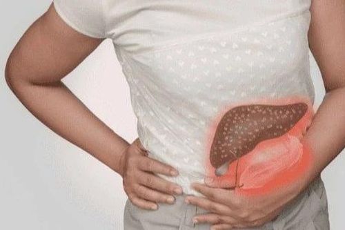 Những dấu hiệu cảnh báo gan nhiễm mỡ không do rượu bia