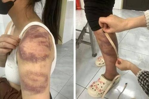 Kẻ bạo hành vợ mang thai và con gái 13 tuổi có thể đối mặt mức án nào?